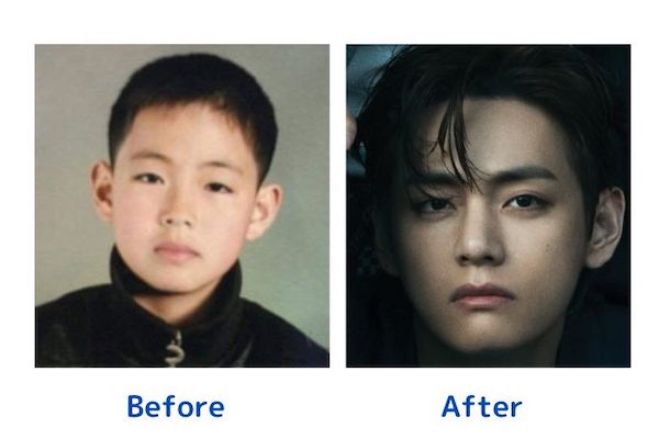 BTSテテ整形疑惑