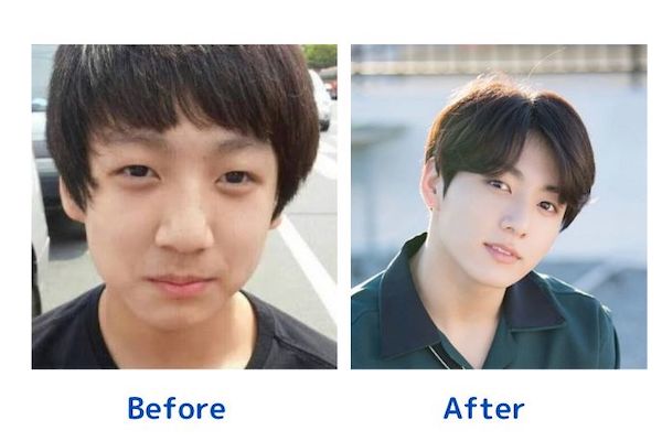 BTSジョンググ整形疑惑